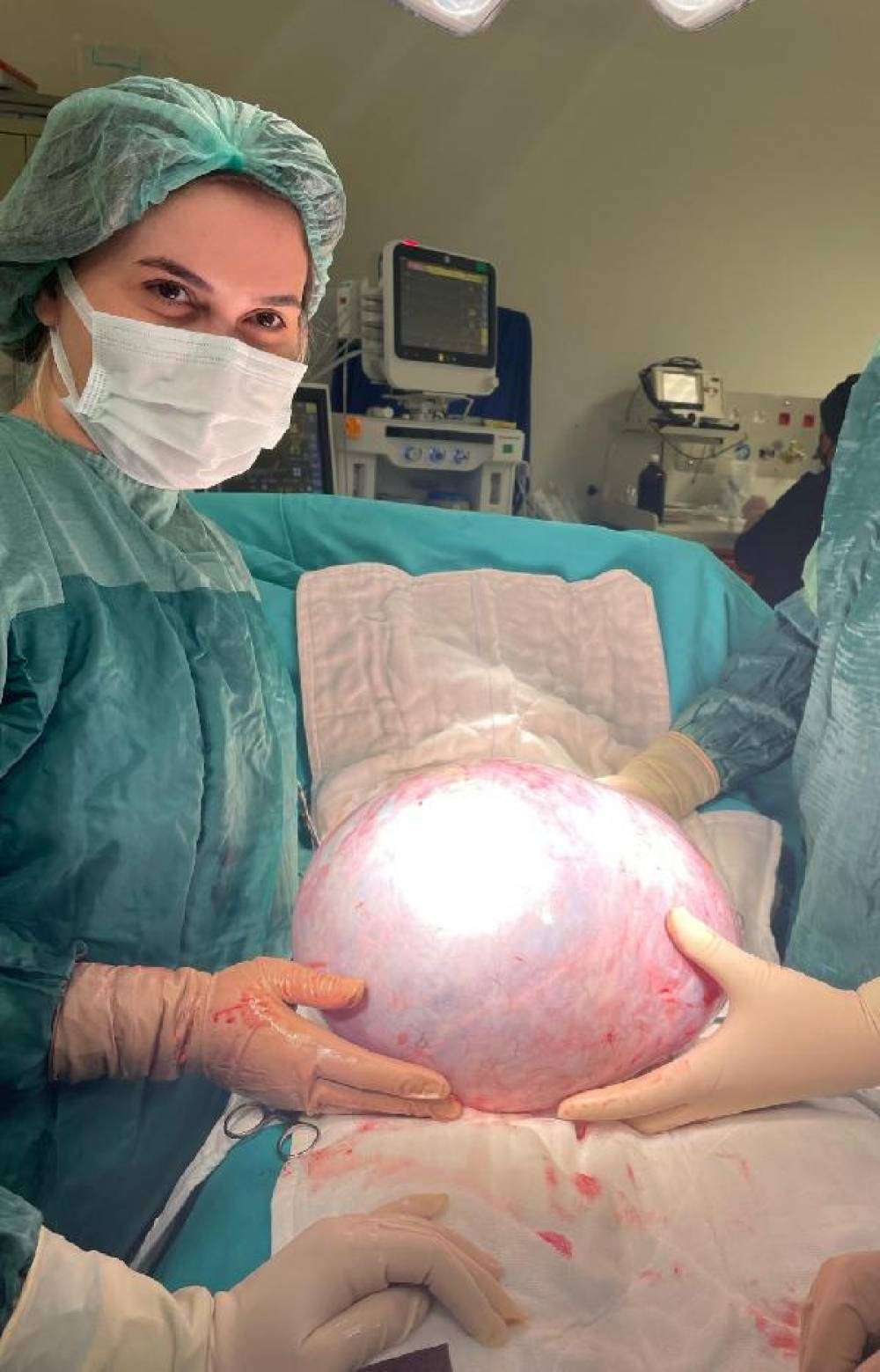 Karnından 9 kiloluk tümör çıktı