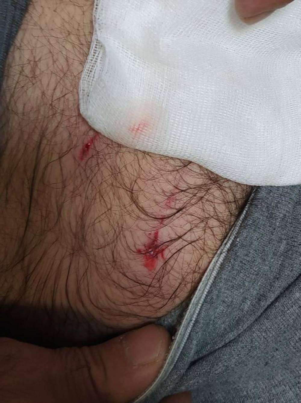 Köpeklerin saldırısına uğrayan baba- oğul yaralandı