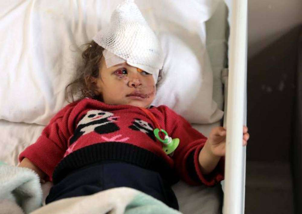 Eşeğin ısırdığı küçük Fatma'ya, boynundan alınan doku ile yeni göz kapağı yapıldı