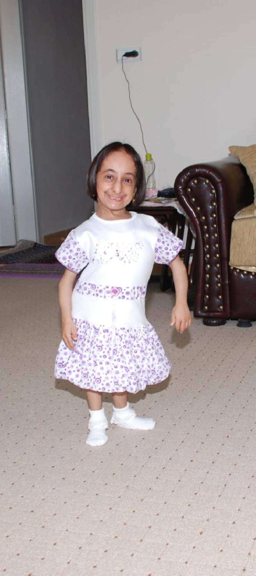 Türkiye'nin en kısa boylu kadını zatürreden hayatını kaybetti